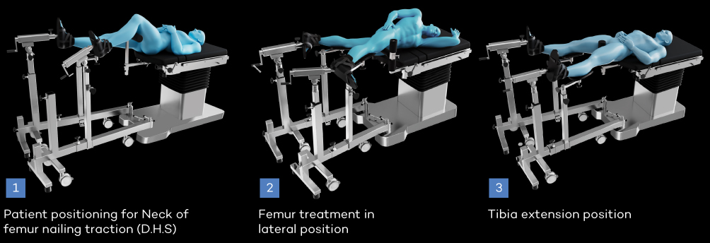 ALBEE'S TYPE Ortho Attachment manufacturer