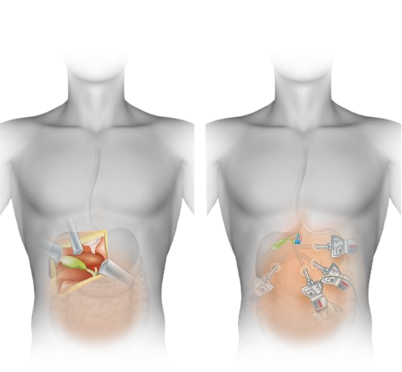 Ceiling Mounted KOMAX Surgical Light