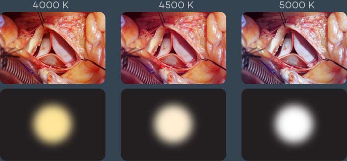 Surgical Operating Light